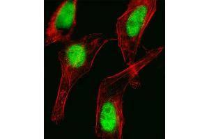 Fluorescent image of Hela cell stained with HOXC10 Antibody . (HOXC10 anticorps  (C-Term))
