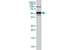 STK38 monoclonal antibody (M05), clone 6G11 Western Blot analysis of STK38 expression in Hela S3 NE . (STK38 anticorps  (AA 365-465))
