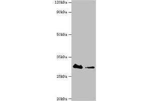Western blot All lanes: Carbonyl reductase [NADPH] 3 antibody at 10 μg/mL Lane 1: Hela whole cell lysate Lane 2: K562 whole cell lysate Secondary Goat polyclonal to rabbit IgG at 1/10000 dilution Predicted band size: 31 kDa Observed band size: 31 kDa (CBR3 anticorps  (AA 118-277))