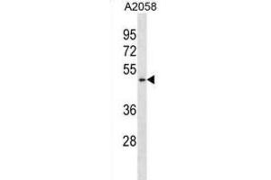 Western Blotting (WB) image for anti-Bifunctional Apoptosis Regulator (BFAR) antibody (ABIN2998941) (BFAR anticorps)