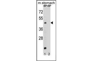 Western blot analysis of MBOAT4 Antibody (Center) Cat.