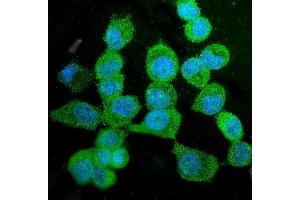 IF analysis of KIF15 using anti-KIF15 antibody (ABIN6719385).