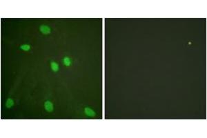 Immunofluorescence analysis of HeLa cells, using Histone H3 (Ab-14) Antibody. (Histone 3 anticorps  (AA 6-55))