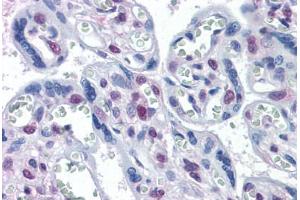 Human Placenta: Formalin-Fixed, Paraffin-Embedded (FFPE) (STK17A anticorps  (AA 301-414))