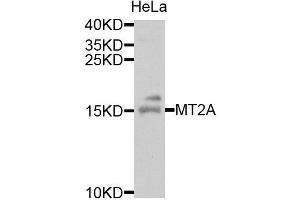 Western blot analysis of extracts of HeLa cells, using MT2A antibody. (MT2A anticorps)