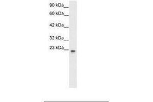 Image no. 2 for anti-General Transcription Factor IIF, Polypeptide 2, 30kDa (GTF2F2) (AA 132-181) antibody (ABIN6735771) (GTF2F2 anticorps  (AA 132-181))