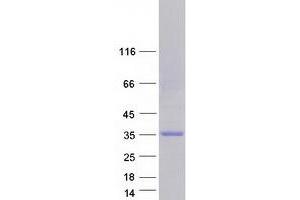 Validation with Western Blot