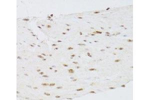 Immunohistochemistry of paraffin-embedded Human stomach using CSRP3 Polyclonal Antibody at dilution of 1:100 (40x lens). (CSRP3 anticorps)