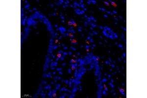 Immunofluorescence of paraffin embedded human appendix using MADCAM1 (ABIN7074695) at dilution of 1:1800 (400x lens) (MADCAM1 anticorps)