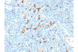 Formalin-fixed, paraffin-embedded human Tonsil stained with IL3RA/CD123 Mouse Monoclonal Antibody (IL3RA/1531).