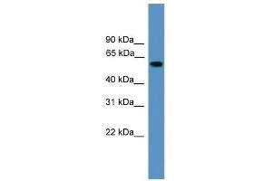 Western Blot showing RAP1GDS1 antibody used at a concentration of 1. (RAP1GDS1 anticorps  (Middle Region))