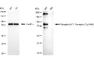 Western blotting analysis using phospho-IGF1 Receptor (Tyr) antibody (ABIN7799048).