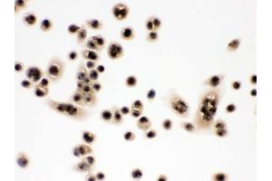 IHC analysis of EIF6 using anti-EIF6 antibody .