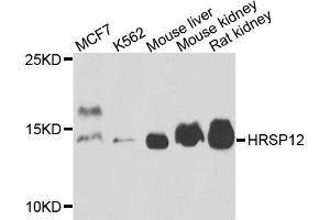 Western blot analysis of extracts of various cell lines, using HRSP12 antibody (ABIN5972464) at 1/1000 dilution. (HRSP12 anticorps)