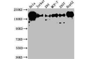 Western Blot Positive WB detected in: Hela whole cell lysate, Jurkat whole cell lysate, 293 whole cell lysate, MCF-7 whole cell lysate, 293T whole cell lysate, HepG2 whole cell lysate All lanes: PELP1 antibody at 1:1000 Secondary Goat polyclonal to rabbit IgG at 1/50000 dilution Predicted band size: 120 kDa Observed band size: 160 kDa (Recombinant PELP1 anticorps)