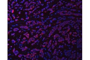 IF analysis of Syntaxin 18/STX18 using anti-Syntaxin 18/STX18 antibody (ABIN7599259). (Syntaxin 18 anticorps  (AA 1-313))