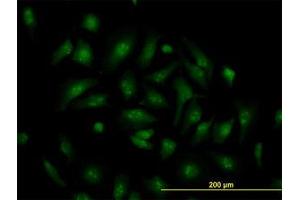 Image no. 2 for anti-Transcription Factor 19 (TCF19) (AA 17-103) antibody (ABIN598965) (TCF19 anticorps  (AA 17-103))