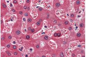 Human Liver (formalin-fixed, paraffin-embedded) stained with RBP4 antibody ABIN364444 at 10 ug/ml followed by biotinylated anti-mouse IgG secondary antibody ABIN481714, alkaline phosphatase-streptavidin and chromogen. (RBP4 anticorps  (AA 19-201))