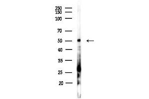 Western blot analysis of lysates from MCF7 cells(heat-shock,45 min treatment), using Casein Kinase 1 delta Antibody at 1/1000 dilution.