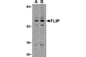 Western Blotting (WB) image for anti-CASP8 and FADD-Like Apoptosis Regulator (CFLAR) (N-Term) antibody (ABIN1031381) (FLIP anticorps  (N-Term))