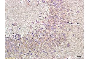 Formalin-fixed and paraffin embedded rat brain labeled with Anti-NPY1R Polyclonal Antibody, Unconjugated  at 1:400 followed by conjugation to the secondary antibody and DAB staining.