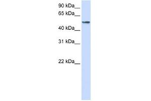 WB Suggested Anti-USP22 Antibody Titration: 0. (USP22 anticorps  (Middle Region))