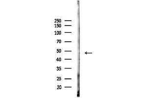 anti-Pregnancy Specific beta-1-Glycoprotein 3 (PSG3) (C-Term) antibody