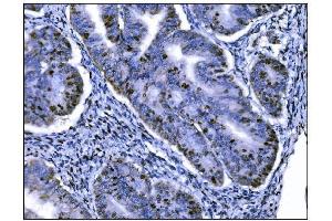 IHC analysis of Ki67 using anti-Ki67 antibody (ABIN7601100). (Ki-67 anticorps  (AA 2860-3256))