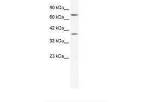 Image no. 1 for anti-Zinc Finger Protein 660 (ZNF660) (C-Term) antibody (ABIN202267) (ZNF660 anticorps  (C-Term))