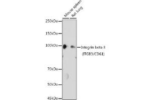 Western blot analysis of extracts of various cell lines, using Integrin beta 3 (ITGB3/CD61) antibody (ABIN6127572, ABIN6142584, ABIN6142586 and ABIN6219636) at 1:1000 dilution. (Integrin beta 3 anticorps  (AA 610-718))