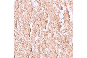 Immunohistochemistry (IHC) image for anti-Solute Carrier Family 39 (Zinc Transporter), Member 10 (SLC39A10) (Middle Region) antibody (ABIN1031176) (SLC39A10 anticorps  (Middle Region))