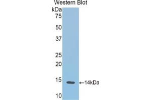 Detection of Recombinant HB, Cattle using Polyclonal Antibody to Hemoglobin (HB) (Hemoglobin anticorps)