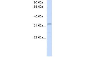 WB Suggested Anti-DOK5 Antibody Titration:  0. (DOK5 anticorps  (N-Term))