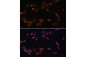 Immunofluorescence analysis of NIH-3T3 cells using CYPOR Polyclonal Antibody (ABIN6130227, ABIN6145969, ABIN6145970 and ABIN7101824) at dilution of 1:100 (40x lens). (POR anticorps  (AA 1-250))