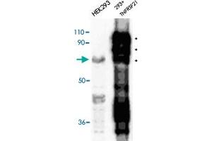 Immunodetection of transfected human TNFRSF21 in HEK 293 cells using TNFRSF21 polyclonal antibody . (TNFRSF21 anticorps  (AA 372-665))