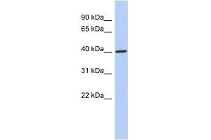 WB Suggested Anti-DDI1 Antibody Titration: 0. (DDI1 anticorps  (Middle Region))