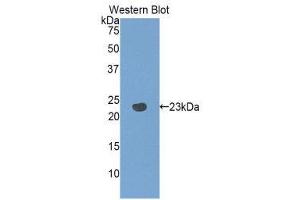 Western Blotting (WB) image for anti-Pannexin 1 (PANX1) (AA 77-260) antibody (ABIN1860124) (PANX1 anticorps  (AA 77-260))