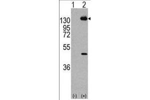 Western blot analysis of PDGFRA (arrow) using rabbit polyclonal PDGFRA Antibody  (R). (PDGFRA anticorps  (AA 746-775))
