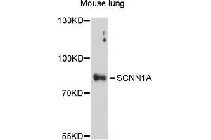 Western blot analysis of extracts of mouse lung, using SCNN1A antibody (ABIN5973225) at 1/1000 dilution. (SCNN1A anticorps)