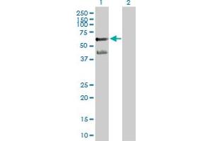 Western Blot analysis of PPARA expression in transfected 293T cell line by PPARA MaxPab polyclonal antibody. (PPARA anticorps  (AA 1-468))