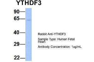Host: Rabbit  Target Name: YTHDF3  Sample Tissue: Human Fetal Heart  Antibody Dilution: 1. (YTHDF3 anticorps  (N-Term))