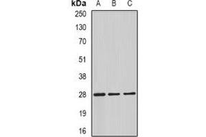 Western blot analysis of C4BP beta expression in HepG2 (A), mouse testis (B), rat testis (C) whole cell lysates. (C4BPB anticorps)