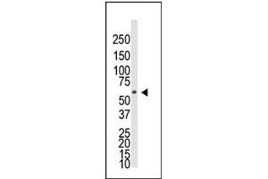 Image no. 1 for anti-Bone Morphogenetic Protein Receptor 1A (BMPR1A) (AA 39-69), (N-Term) antibody (ABIN357372)