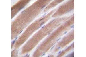 IHC testing of VEGFC antibody and FFPE human skeletal muscle. (VEGFC anticorps  (AA 20-49))