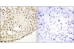 Immunohistochemistry analysis of paraffin-embedded human testis tissue, using SPZ1 Antibody. (SPZ1 anticorps  (AA 111-160))