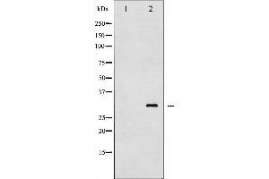 Western blot analysis of TNNI3 phosphorylation expression in Mouse hearttissue lysates,The lane on the left is treated with the antigen-specific peptide. (TNNI3 anticorps  (pThr143))