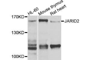 Western blot analysis of extracts of various cells, using JARID2 antibody. (JARID2 anticorps)