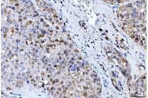 IHC analysis of FEN1 using anti-FEN1 antibody (ABIN7601619). (FEN1 anticorps  (AA 4-300))