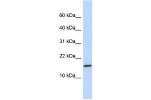 NCRNA00114 antibody used at 1 ug/ml to detect target protein. (NCRNA00114 anticorps  (N-Term))