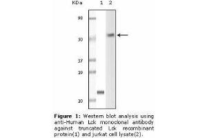 Image no. 1 for anti-Lymphocyte-Specific Protein tyrosine Kinase (LCK) antibody (ABIN232106) (LCK anticorps)